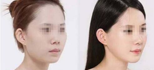 揭秘北京醫(yī)美界領先的8家私立吸脂手術醫(yī)院