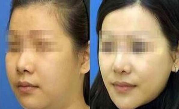南京市優(yōu)質(zhì)整形醫(yī)院排行榜最新發(fā)布