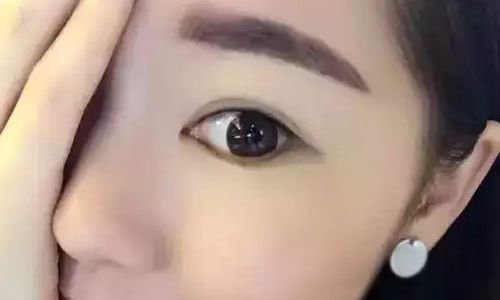 上海知名隆下巴醫(yī)生推薦:完整的名單和價格信息 上海知名隆下巴醫(yī)生推薦:完整的名單和價格信息