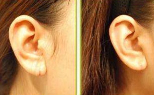 如何在3天內(nèi)瘦下屁股？7個(gè)有效方法大揭秘！