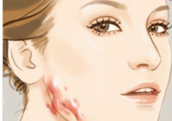 北京哪家醫(yī)院可以洗紋身呢？