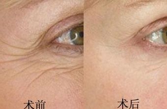 南京鳳凰島整形外科門診部的王科醫(yī)生口碑如何？聯(lián)合李敏醫(yī)生介紹及手術(shù)后的反饋，揭秘這位醫(yī)生的實(shí)力！