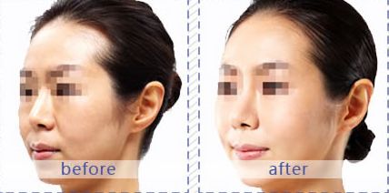 成都哪家醫(yī)院適合皮膚美容？