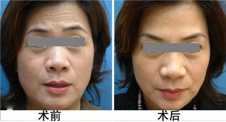 廣安阿藍醫(yī)院整形科評價，是否正規(guī)？地址詳細一覽