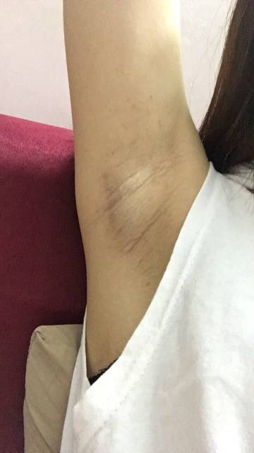 上海健橋植發(fā)技術實力如何？頭發(fā)再生效果值得期待嗎？
