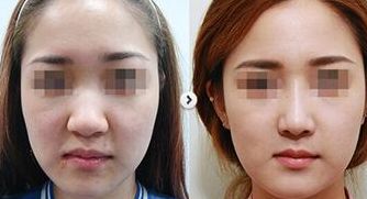 廣州中大光華醫(yī)院，品質(zhì)獲GL國際認證，真實患者評價分享