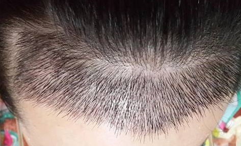 蒲城縣醫(yī)院簡介：如何了解蒲城縣醫(yī)院的特色服務(wù)與專業(yè)醫(yī)療團隊？