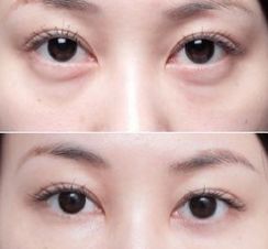 上海美萊醫(yī)院的療效一流，備受好評的醫(yī)生大揭秘！