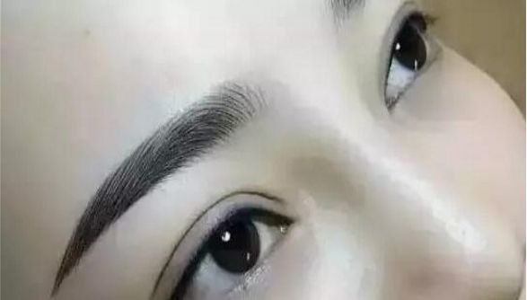 重慶曹陽的鼻子整形效果如何？醫(yī)生手藝獨步天下的真實案例分享