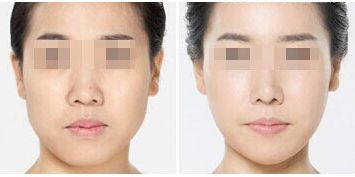 深圳整形美容醫(yī)院排名前十，哪家更受用戶好評？