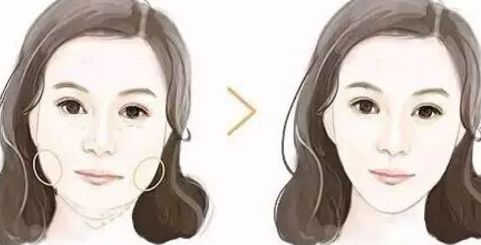 廣州拉皮手術(shù)哪里做效果好？華美、曙光等知名醫(yī)院上榜！