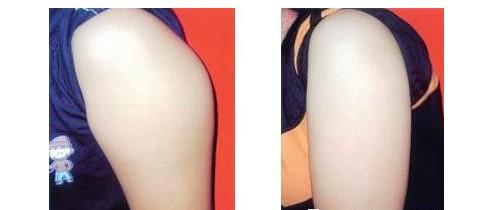 上海九院的整形價(jià)格表是怎樣的？它適合想要變美的人嗎？