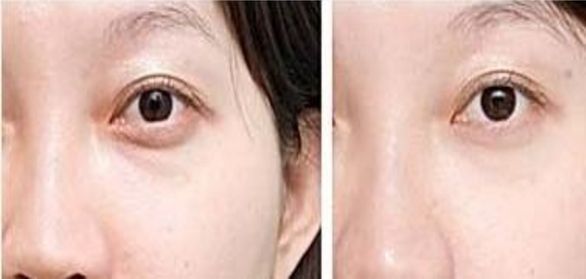 上海排名靠前的整形醫(yī)院推薦，想知道哪家好？最受歡迎的三甲醫(yī)療機(jī)構(gòu)名單已公布！
