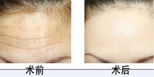 北京協(xié)和整形科的醫(yī)術(shù)高超，專家團(tuán)隊(duì)實(shí)力強(qiáng)大，您值得信賴