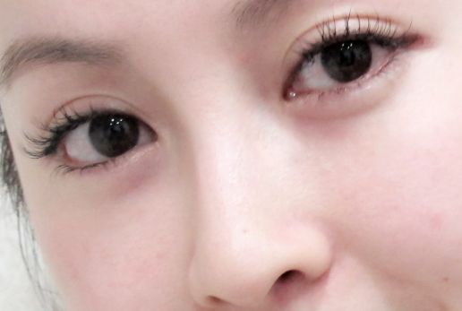 汕頭哪家醫(yī)美機構(gòu)正規(guī)可信呢？