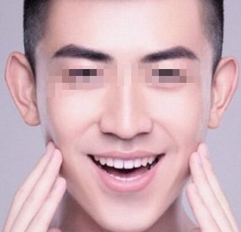 北京治疤痕手術(shù)哪家醫(yī)院好？