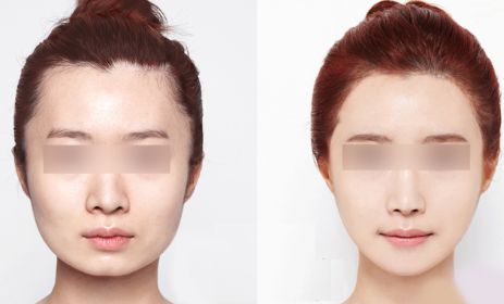 昆明哪里有最好的眼部手術(shù)整形醫(yī)院？2024年10家排名搶先曝光！