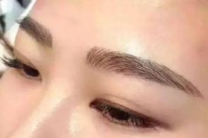 絕佳效果！體驗(yàn)成都周維開刀雙眼皮的精彩案例