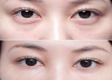 北京最受歡迎的整形醫(yī)院排名高居前三！私立醫(yī)美實力超越公立醫(yī)院！