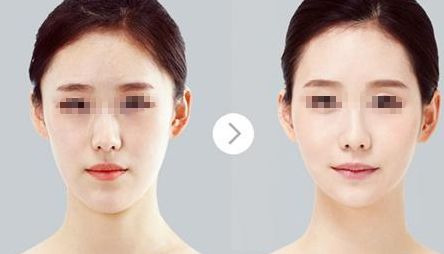 鄭州哪家醫(yī)院比較好做唇部整形？