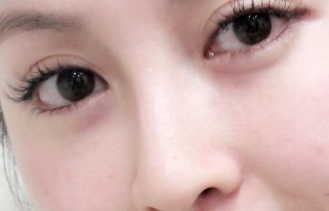 廣州熱瑪吉授權(quán)醫(yī)院有哪些好？