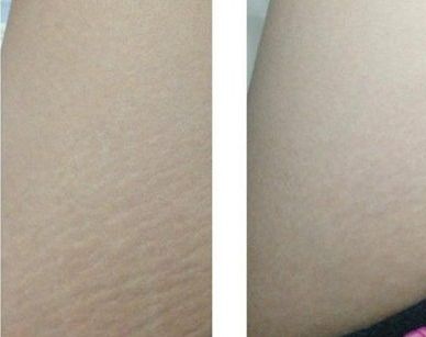 揭秘株洲五家頗受歡迎的整形美容醫(yī)院，哪一家比較好？