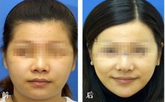 昆明乳房整形哪家醫(yī)院專業(yè)可信？榜單前五推薦，選你中意的