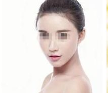 深圳哪家醫(yī)院能安全有效地進行隆鼻整形？