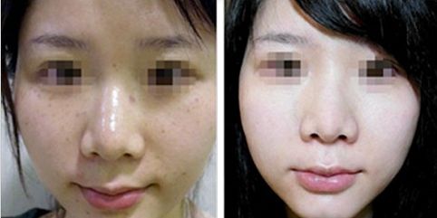 合肥哪幾家三甲整形醫(yī)院受歡迎？