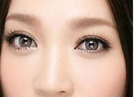 2023年，出色表現(xiàn)的國(guó)外進(jìn)口玻尿酸排行榜前十品牌揭曉！