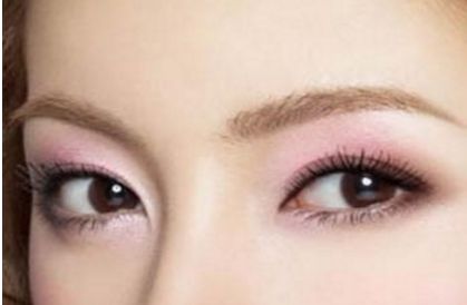 北京協(xié)和醫(yī)院白明醫(yī)生的雙眼皮手術(shù)效果如何？真實(shí)案例展示給你看