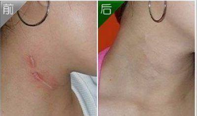 珠江醫(yī)院口碑評價_整形技術(shù)分析+隆胸案例對比圖分享 珠江醫(yī)院口碑評價_整形技術(shù)分析+隆胸案例對比圖分享