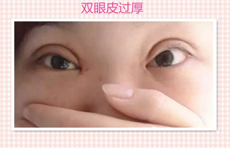 汕頭伊麗莎白醫(yī)療美容診所服務(wù)口碑分析，醫(yī)生實(shí)力深度解讀__成功案例報(bào)道