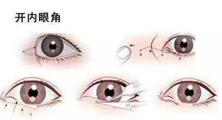 廣州畸形耳朵手術(shù)？值得收藏的醫(yī)院推薦！