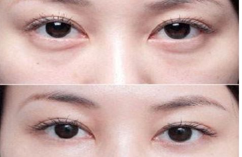 沈陽(yáng)哪個(gè)醫(yī)院的整形專家口碑好，醫(yī)術(shù)高超的醫(yī)生推薦