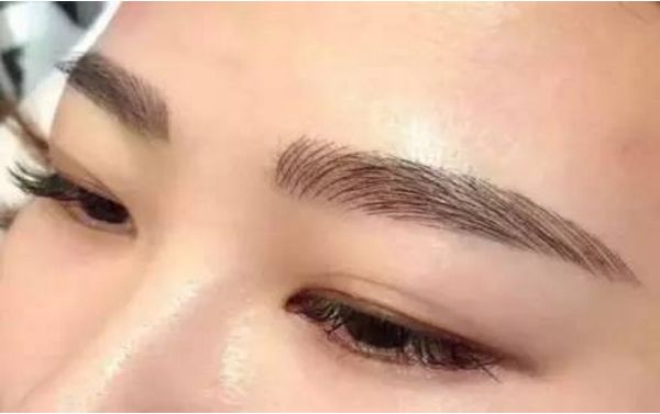 何晉龍磨骨成功，面容煥然一新！讓人難以置信的手術(shù)效果！