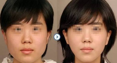 昆明頂尖眼部醫(yī)生一覽:驚人實(shí)力的前五位專家名單曝光 昆明頂尖眼部醫(yī)生一覽:驚人實(shí)力的前五位專家名單曝光