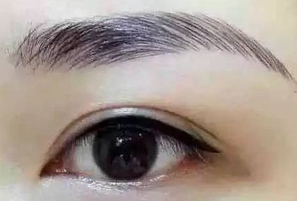 各路醫(yī)生實力大比拼！同帥與楊亞益，誰在雙眼皮手術(shù)上更出彩？