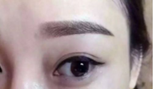 鄭州哪家整形醫(yī)院排名前五，取出異物效果好