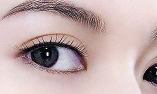太玲美眸重現(xiàn)！揭秘雙眼皮新趨勢，驚艷效果讓人眼前一亮