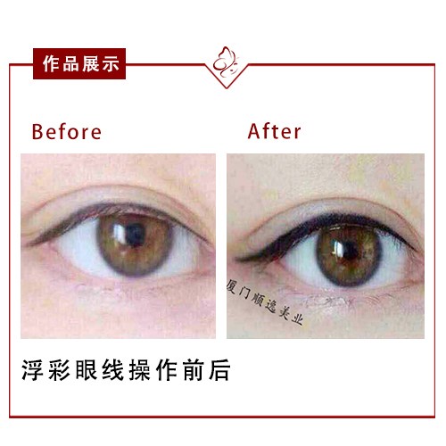 華美整形醫(yī)院在廣州口碑如何？高順福、袁耀東醫(yī)生值得信賴嗎？