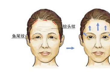 西京整形醫(yī)院：雙眼皮手術憑什么贏得專家認可？親身經(jīng)歷分享