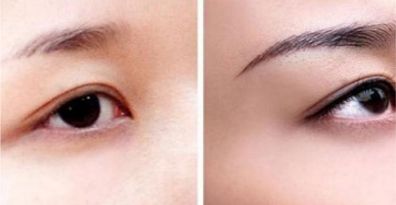 重慶頂尖眼部整形醫(yī)生、醫(yī)院排行榜一覽