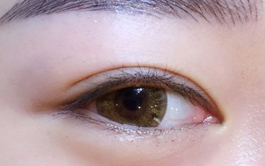 上海九院丨戴傳昌鼻子整形費用明細及專業(yè)技術解析 上海九院丨戴傳昌鼻子整形費用明細及專業(yè)技術解析