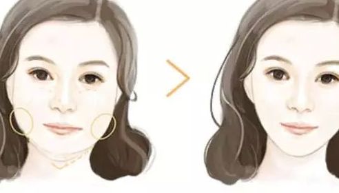 濟(jì)南整形美容醫(yī)院哪家好？諾德、藝星、韓氏躋身手術(shù)排行榜