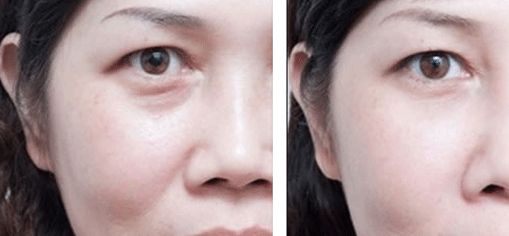 富陽區(qū)去疤整形哪家醫(yī)院口碑好？排行榜前六大推薦！醫(yī)術實力分享值得借鑒