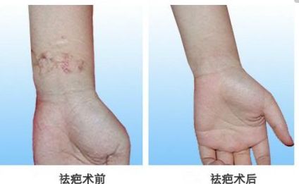 北京自體脂肪隆胸專家真實(shí)排行，專業(yè)技術(shù)精粹一同分享