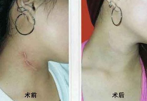 重慶乳房整形六大權(quán)威醫(yī)生盤點，高素質(zhì)專家排行曝光