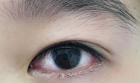 上海整形界最受歡迎的吸脂專家推薦，李耐國、曹衛(wèi)剛、李發(fā)成等醫(yī)生備受贊譽！附真實案例供參考