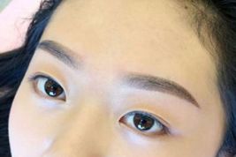 如何優(yōu)雅地?fù)碛须p眼皮？了解專家經(jīng)驗與最新案例！